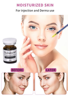 تجميل التجميل 5 مل مكافحة الشيخوخة ميكرونيدلينغ حمض الهيالورونيك حقن حشو