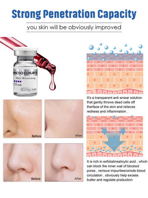 LUXURY Meso Serum Microneedling - خلاصة تبييض البشرة على الفور ، 10 مل