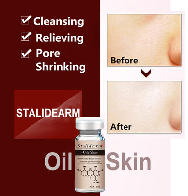 مصل عشبي عضوي مضاد لحب الشباب حسب الطلب Dermapen Face Essence للبشرة الدهنية