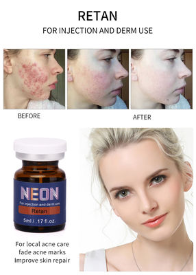 Neon Meso Therapy Serum Injection 5ml مصل علاج حب الشباب Pure Essence