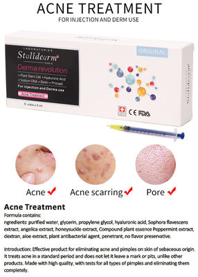 معالجة حب الشباب من الجسم الخارجي (Exosome Acne Treatment Mesotherapy Solution Skin Booster Botox)
